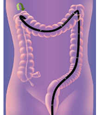 下部消化管（大腸）の検査について